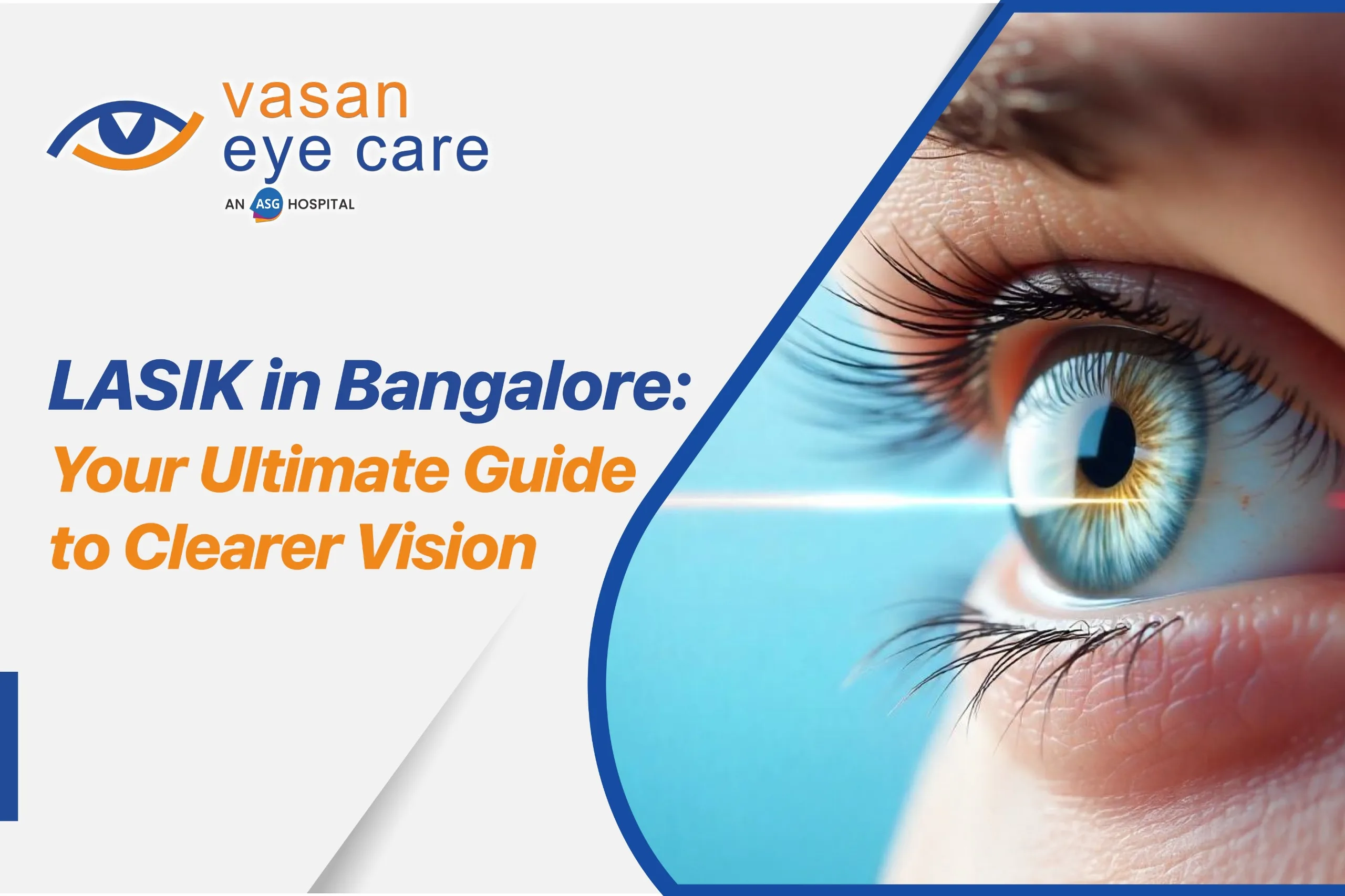 Lasik Surgery in Bangalore