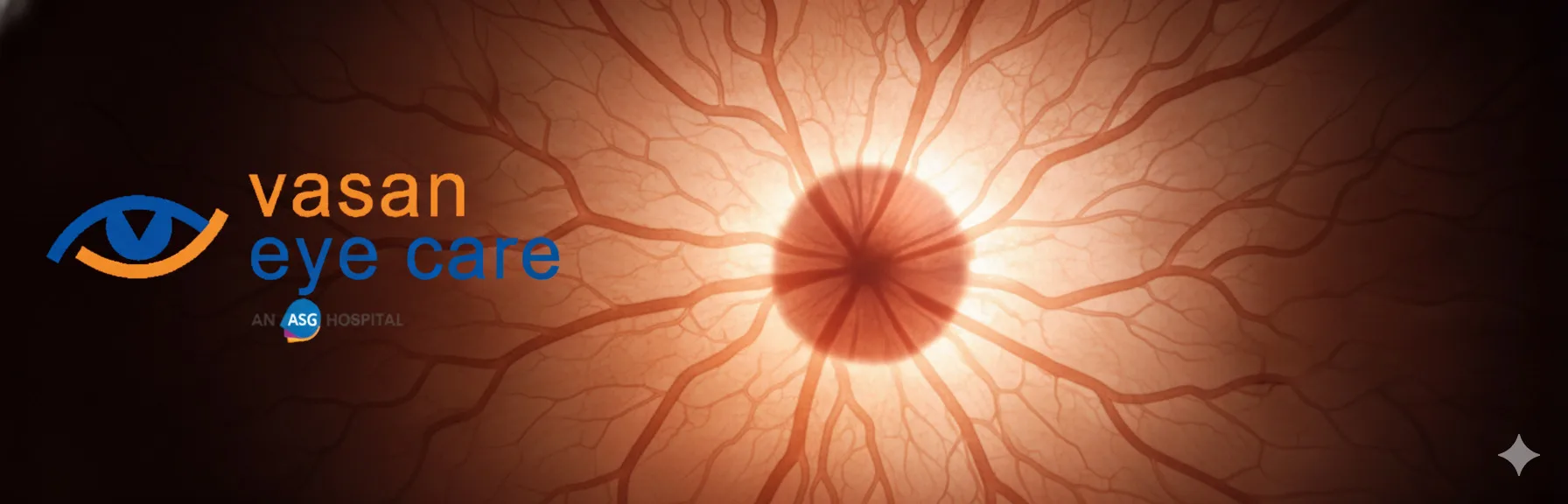 Advanced Retina Services and Treatments at Vasan Eye Care Bangalore