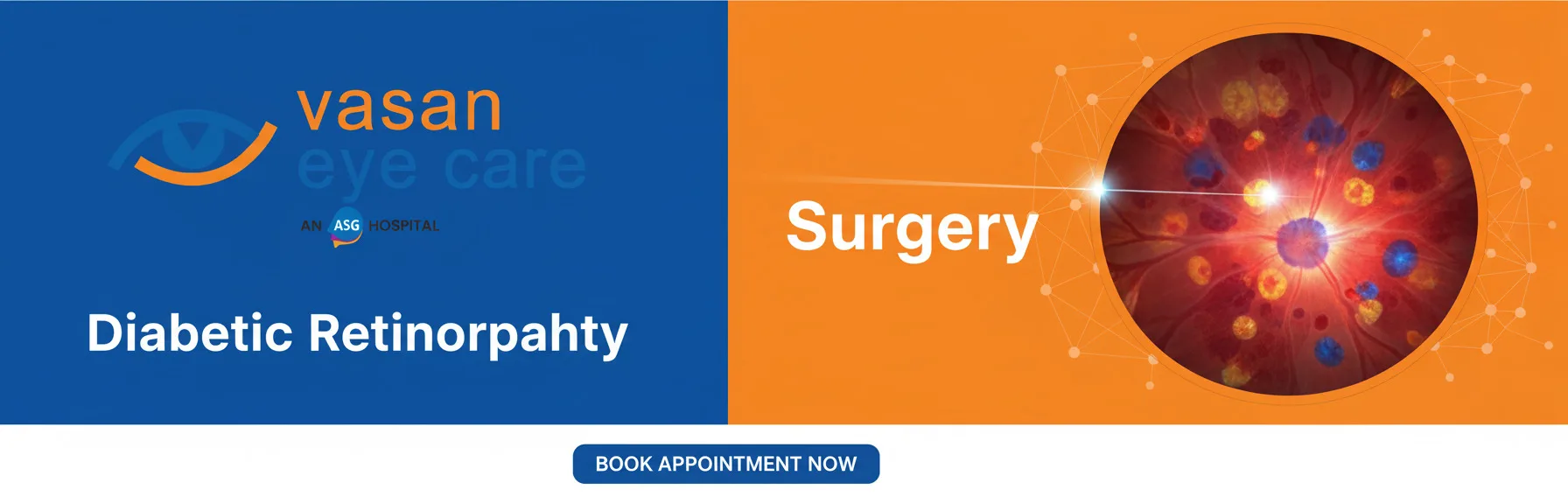 Restore Your Vision with Diabetic Retinopathy Surgery in Trivandrum