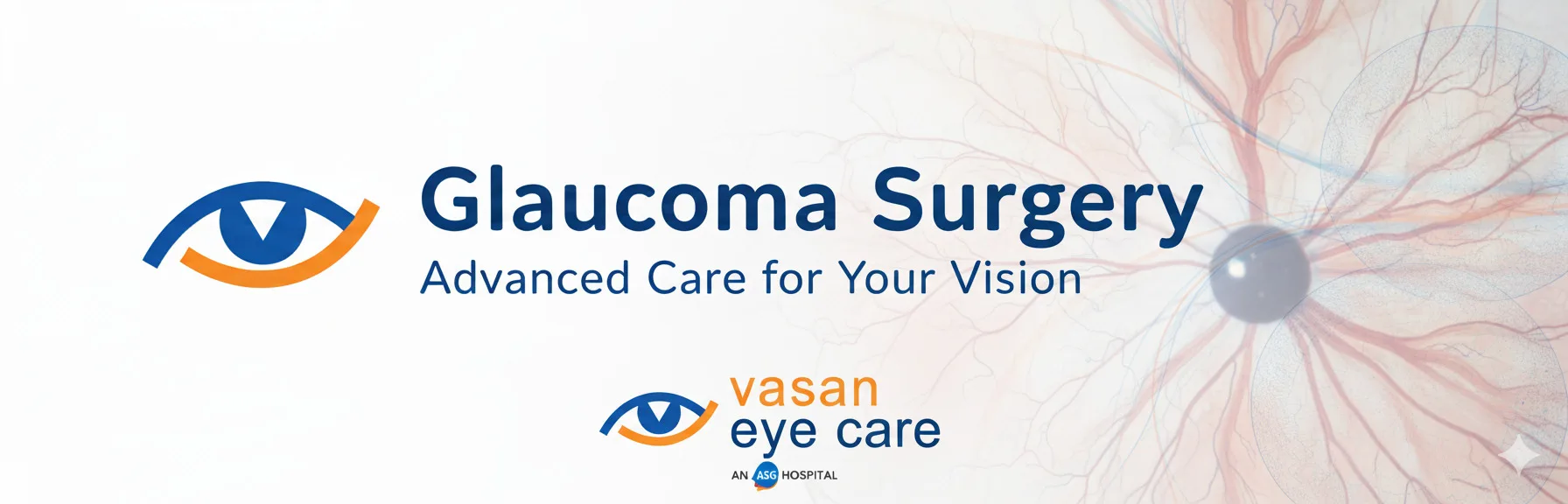 Glaucoma Surgery in Chennai What You Need to Know