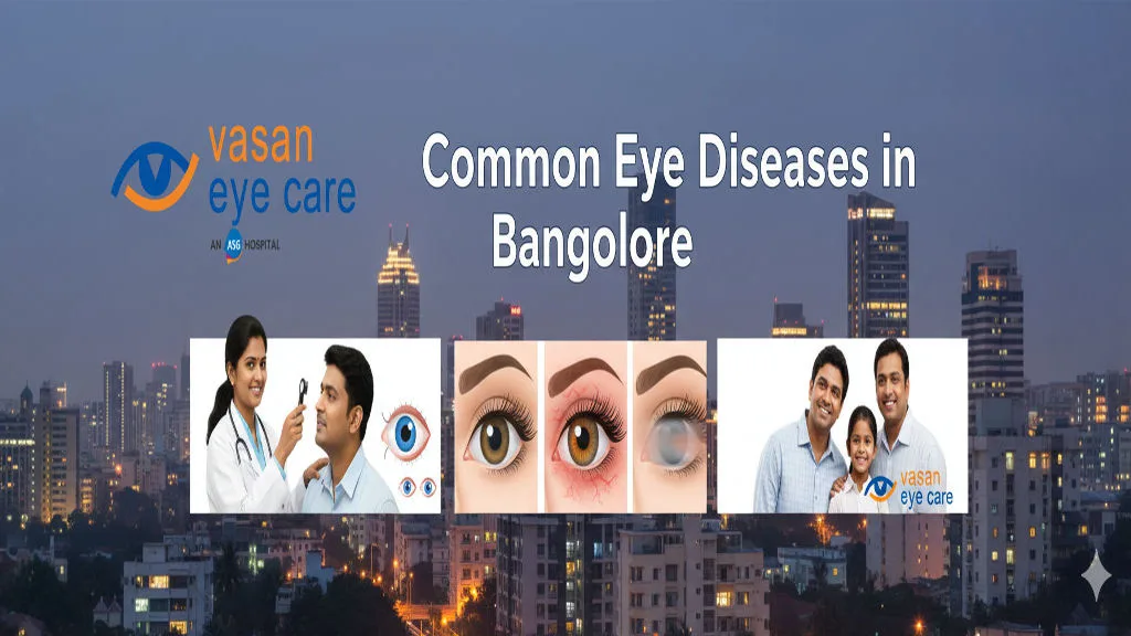 Common Eye Diseases in Bangalore
