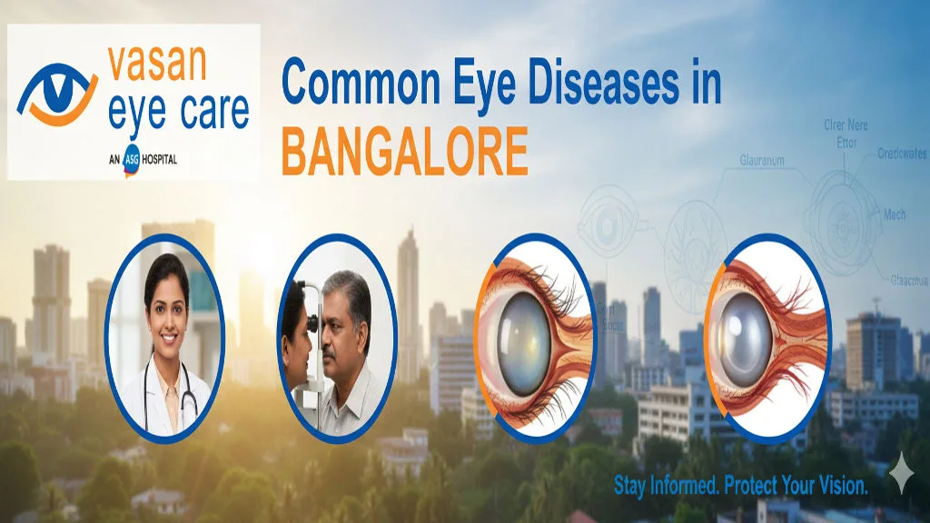 Most Common Eye Diseases in Bangalore