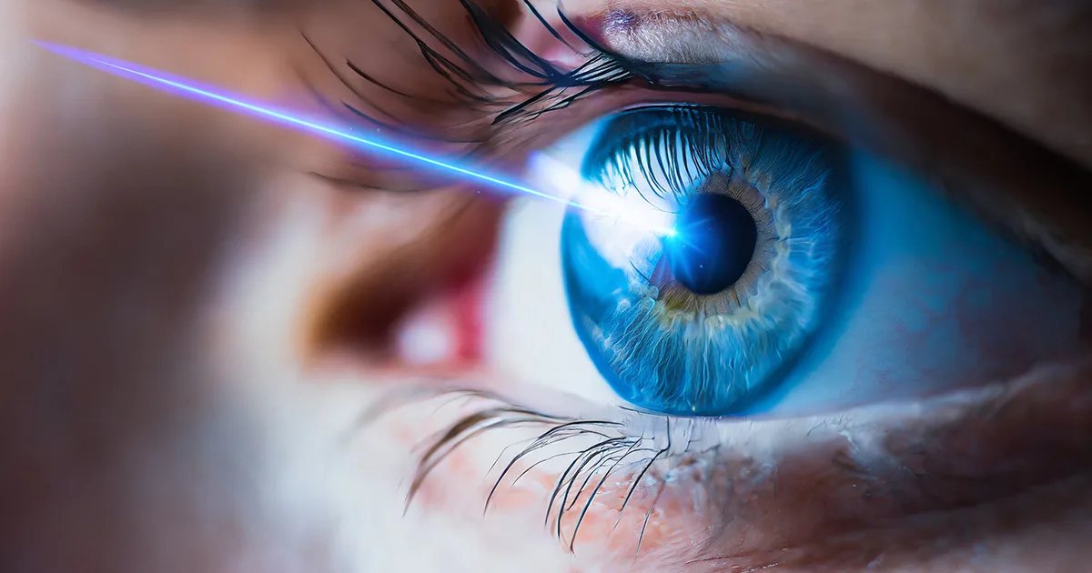 lasik eye surgery recovery time