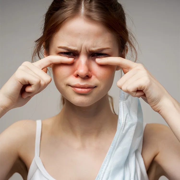 Allergic Conjunctivitis