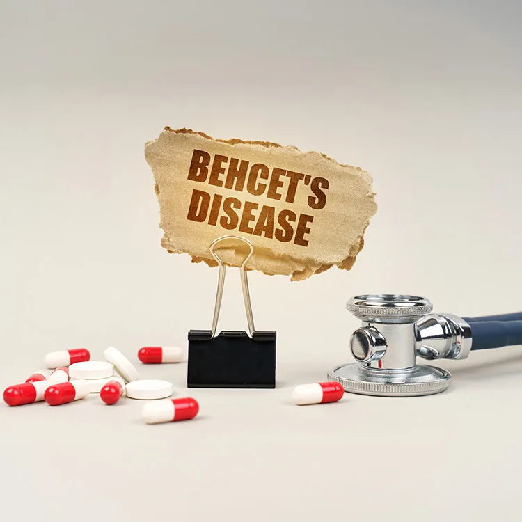 Behcet’s Disease