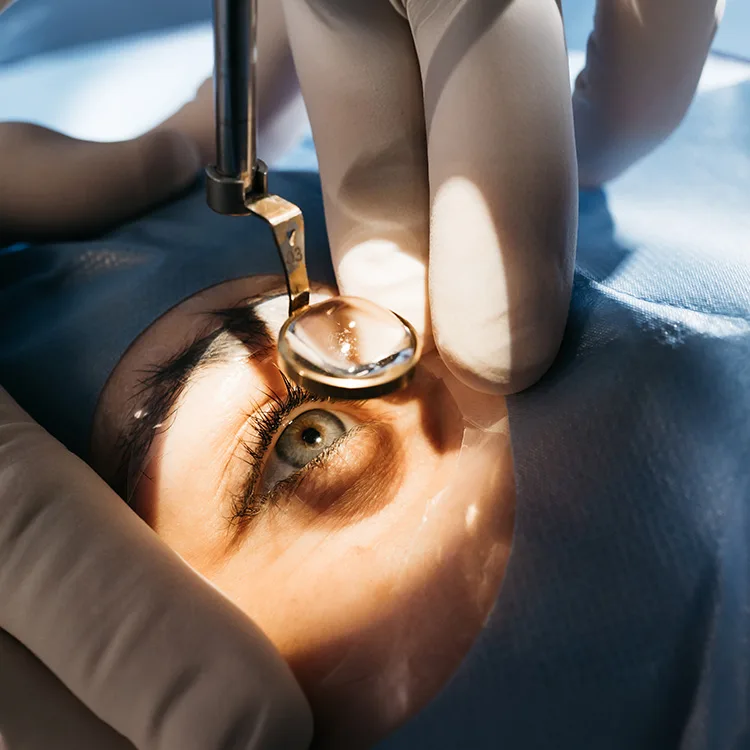 Cataract Diagnosis Treatment