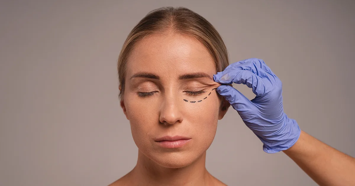 Oculoplasty eye surgery procedure
