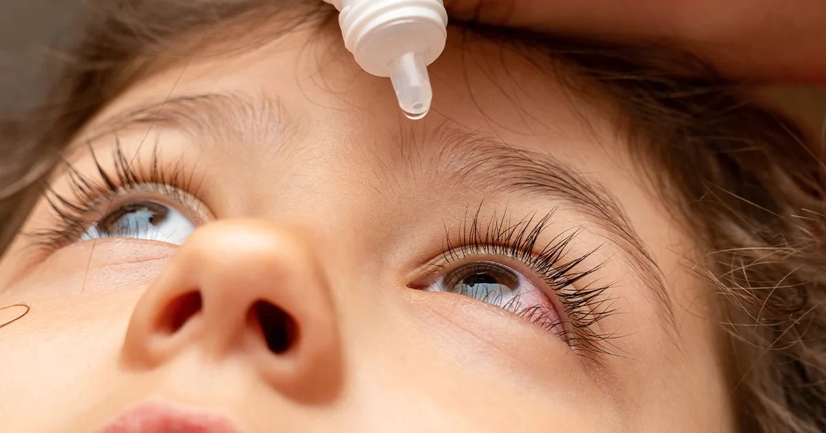 Pink eye conjunctivitis symptoms