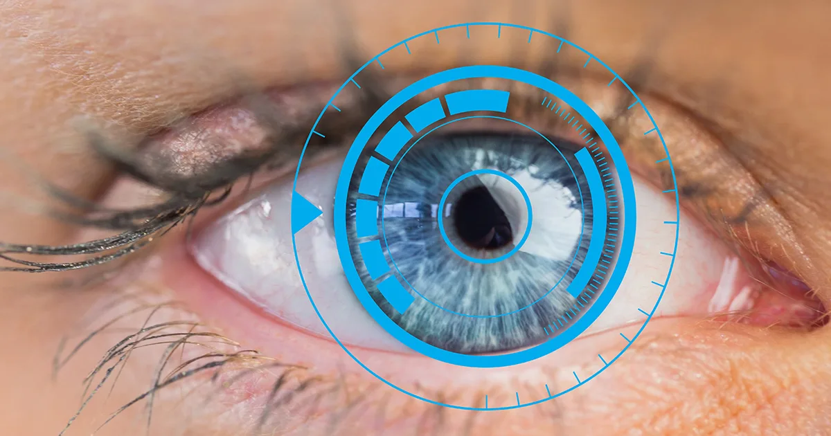 Placido disc corneal topography