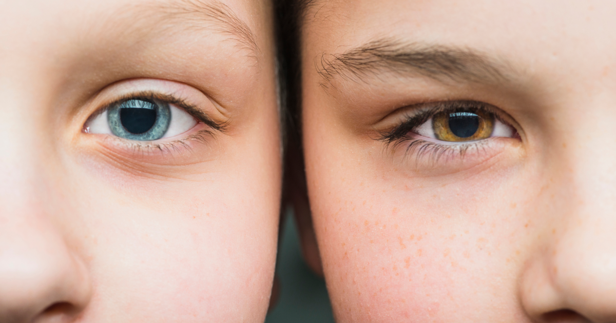 Comparison of brown and blue eyes