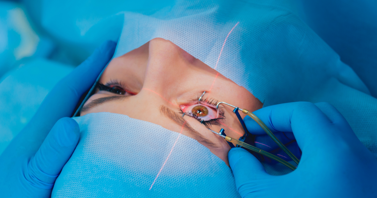 Femtosecond LASIK procedure